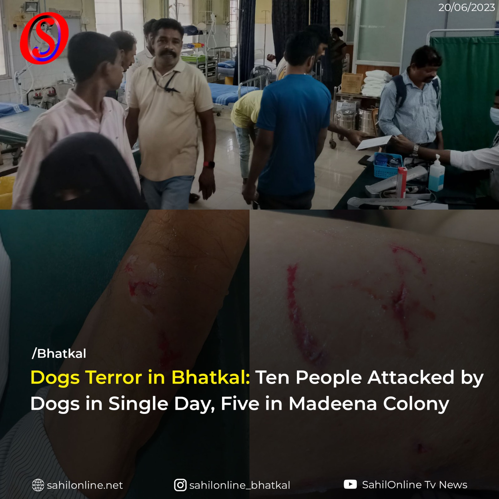 More than 10 injured in stray Dog Attacks, concerns raised in Bhatkal