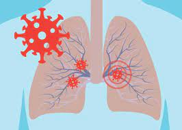 Covid Can Persist In Lungs For Up To 2 Years: Study