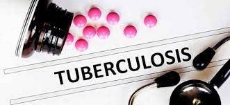 Record 7.5 Million Diagnosed With Tuberculosis Globally In 2022: WHO